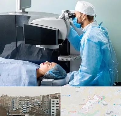 مرکز لیزیک چشم در محمد شهر کرج