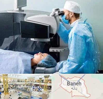 مرکز لیزیک چشم در بانه