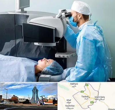 مرکز لیزیک چشم در تایباد