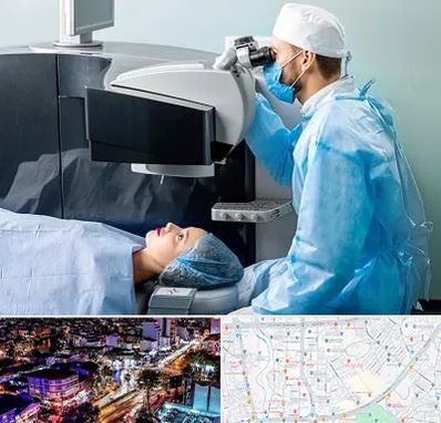 مرکز لیزیک چشم در منظریه رشت