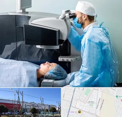 مرکز لیزیک چشم در فاز دو اندیشه