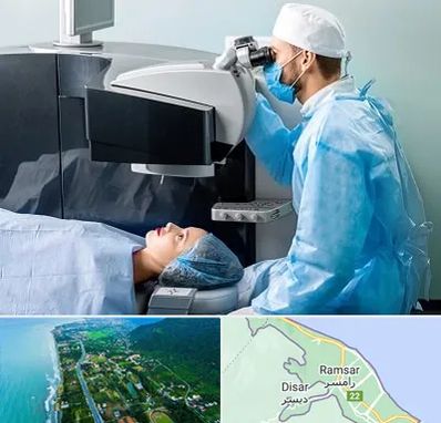مرکز لیزیک چشم در رامسر