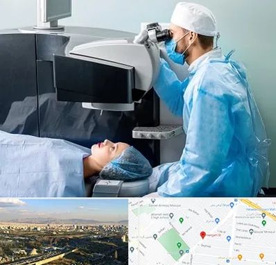 مرکز لیزیک چشم در هنگام