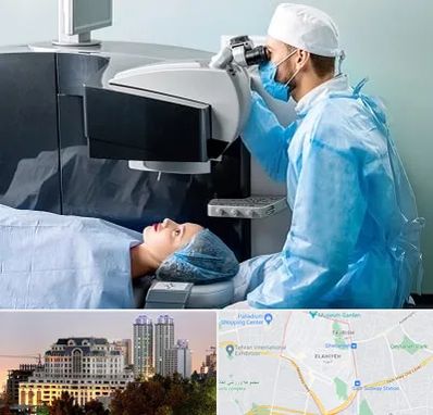 مرکز لیزیک چشم در فرشته