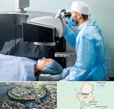 مرکز لیزیک چشم در بابل