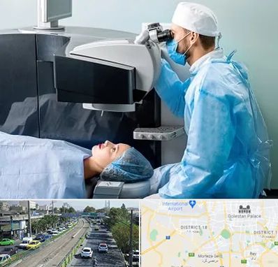 مرکز لیزیک چشم در جنوب تهران