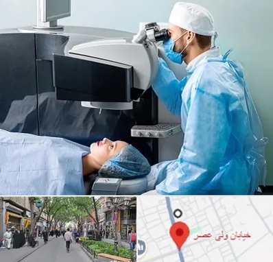 مرکز لیزیک چشم در ولیعصر شهریار