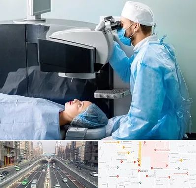 مرکز لیزیک چشم در توحید