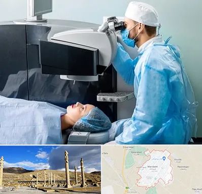 مرکز لیزیک چشم در مرودشت