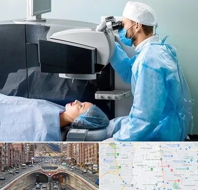 مرکز لیزیک چشم در منطقه 10 تهران