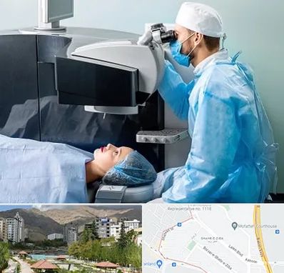 مرکز لیزیک چشم در شهر زیبا