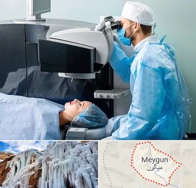 مرکز لیزیک چشم در میگون