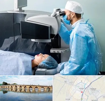 مرکز لیزیک چشم در فلاورجان