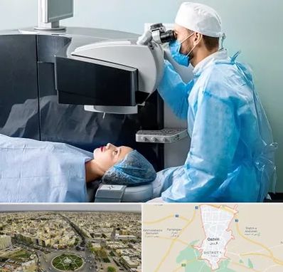 مرکز لیزیک چشم در قزوین