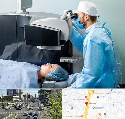 مرکز لیزیک چشم در ستاری