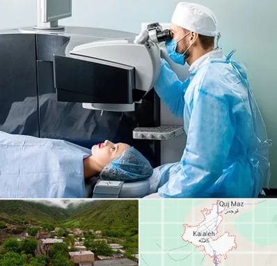 مرکز لیزیک چشم در کلاله