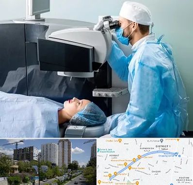 مرکز لیزیک چشم در اندرزگو