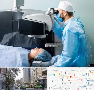 مرکز لیزیک چشم در فاطمی
