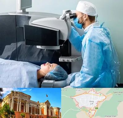 مرکز لیزیک چشم در خوی