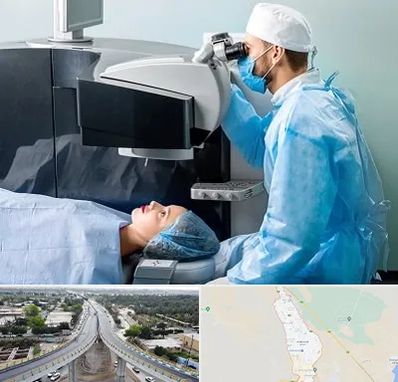 مرکز لیزیک چشم در اندیمشک
