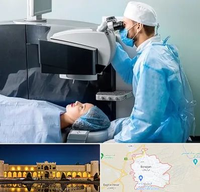 مرکز لیزیک چشم در برازجان