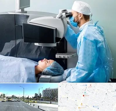 مرکز لیزیک چشم در بلوار کلاهدوز مشهد