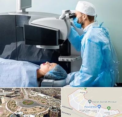 مرکز لیزیک چشم در پرند