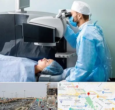 مرکز لیزیک چشم در بلوار توس مشهد