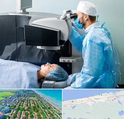 مرکز لیزیک چشم در فریدونکنار