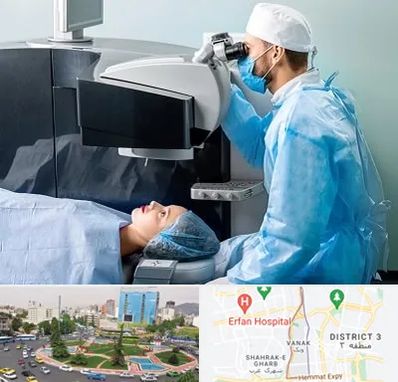 مرکز لیزیک چشم در ونک تهران