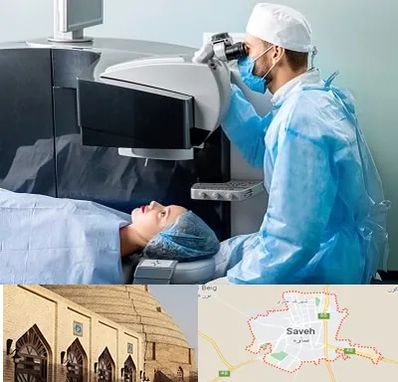 مرکز لیزیک چشم در ساوه