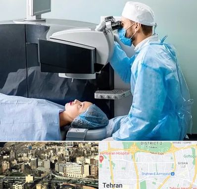 مرکز لیزیک چشم در مرزداران