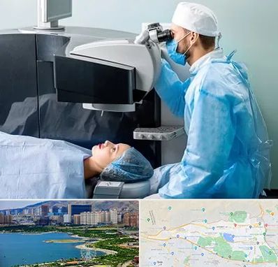مرکز لیزیک چشم در منطقه 22 تهران