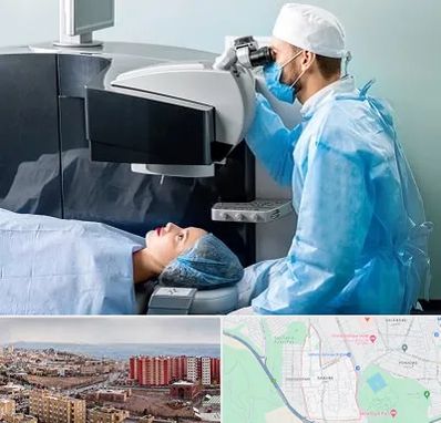 مرکز لیزیک چشم در سهند تبریز