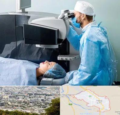 مرکز لیزیک چشم در یاسوج
