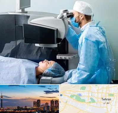 مرکز لیزیک چشم در غرب تهران