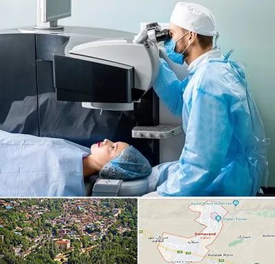 مرکز لیزیک چشم در دماوند