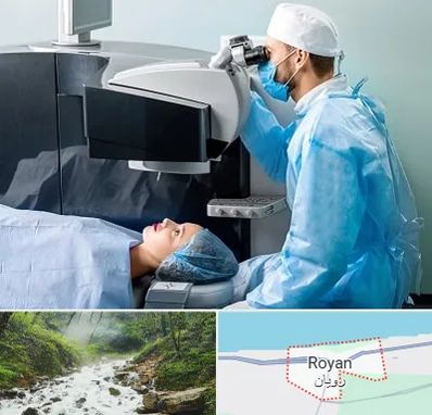 مرکز لیزیک چشم در رویان