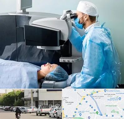 مرکز لیزیک چشم در قدوسی شرقی شیراز