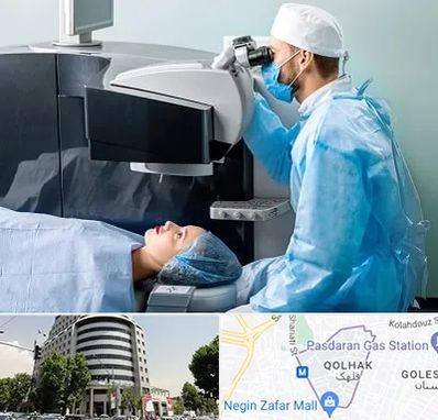 مرکز لیزیک چشم در قلهک