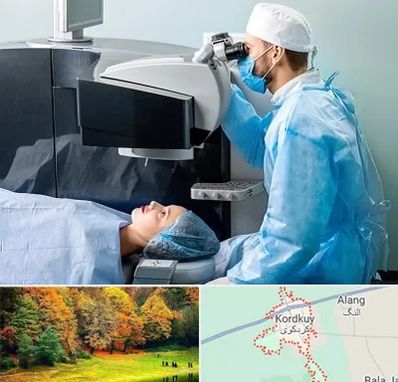 مرکز لیزیک چشم در کردکوی
