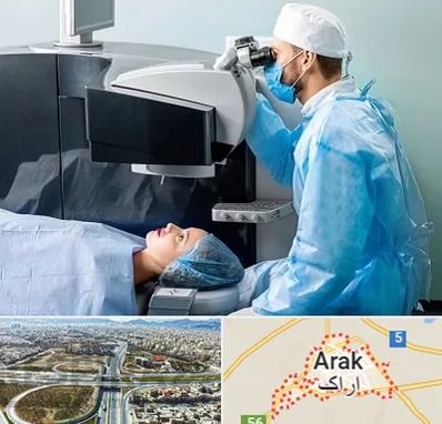 مرکز لیزیک چشم در اراک
