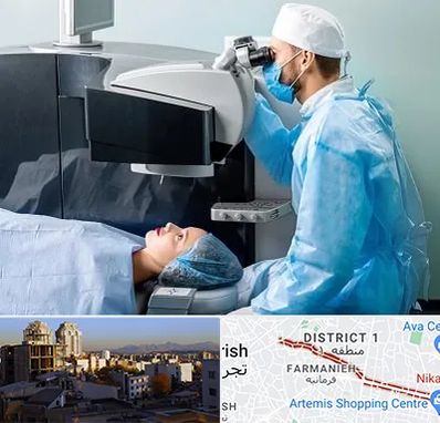 مرکز لیزیک چشم در فرمانیه