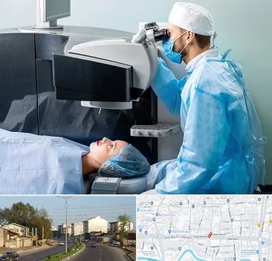 مرکز لیزیک چشم در ضیابری رشت