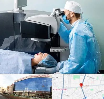 مرکز لیزیک چشم در نصف راه تبریز
