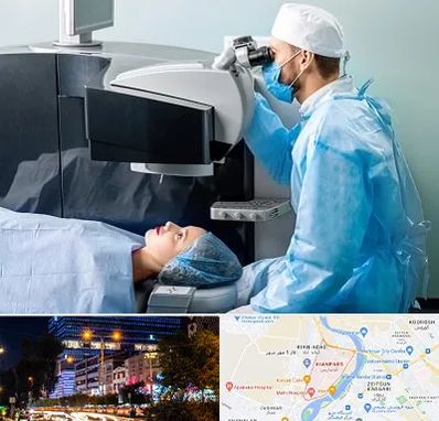 مرکز لیزیک چشم در کیانپارس اهواز