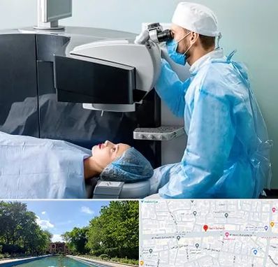 مرکز لیزیک چشم در هشت بهشت اصفهان