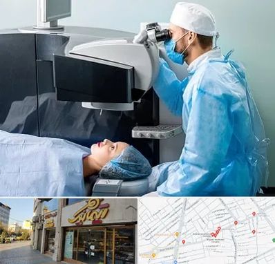 مرکز لیزیک چشم در عطاران قم