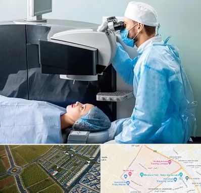 مرکز لیزیک چشم در الهیه مشهد
