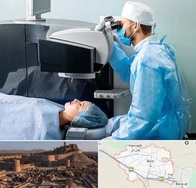 مرکز لیزیک چشم در بم